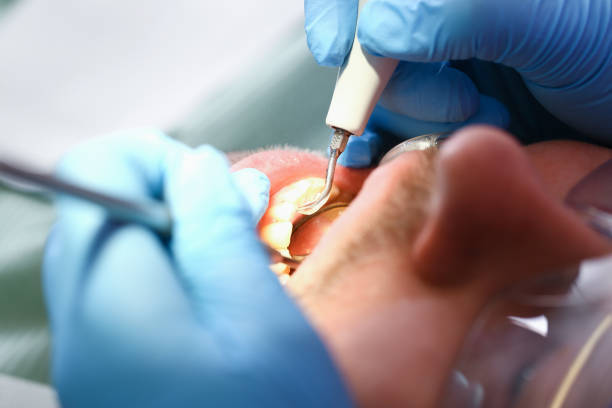 Best Broken or Cracked Tooth Emergency Dentist in Cornelia, GA