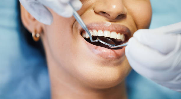 Best Emergency Dentist for Lost Fillings or Crowns in Cornelia, GA